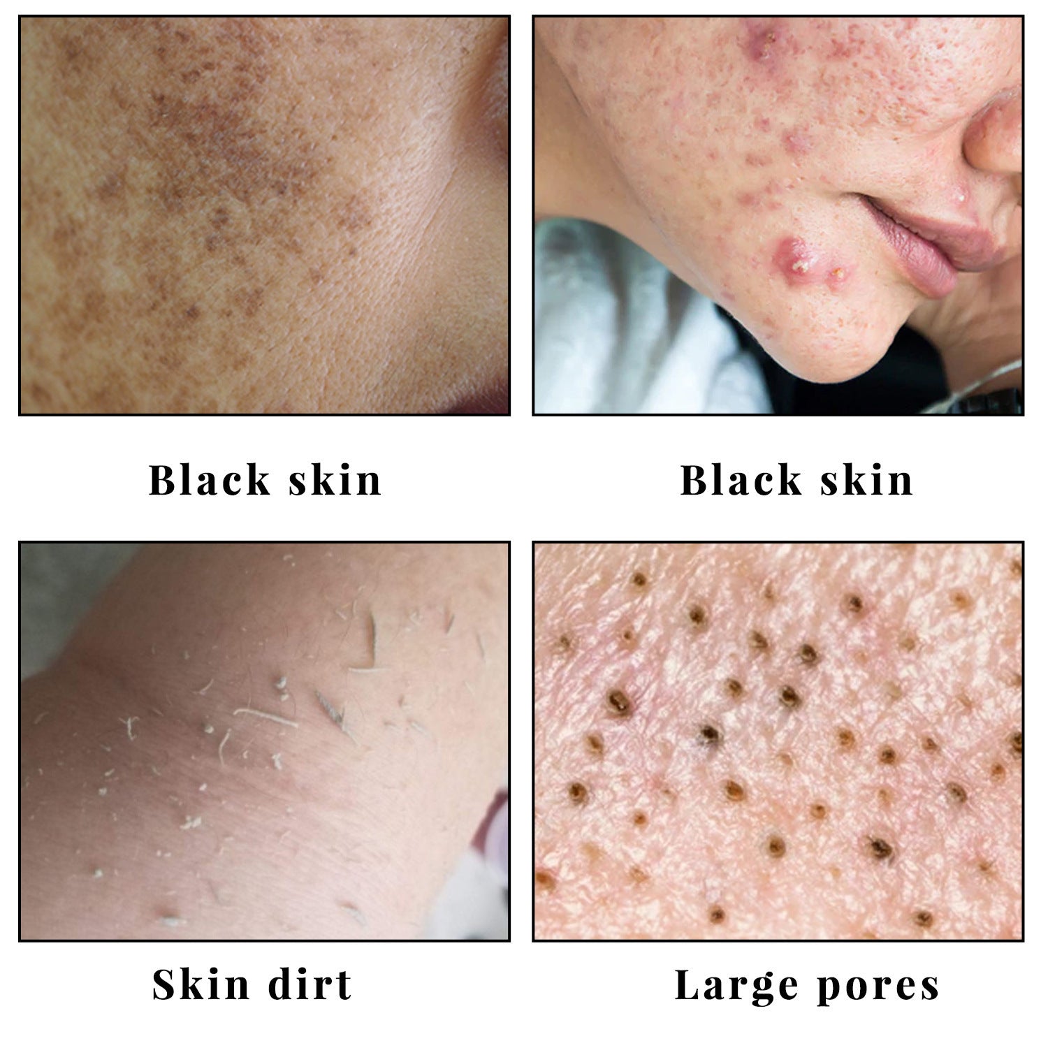 Face Wash Facial Soap Cleansing And Moisturizing